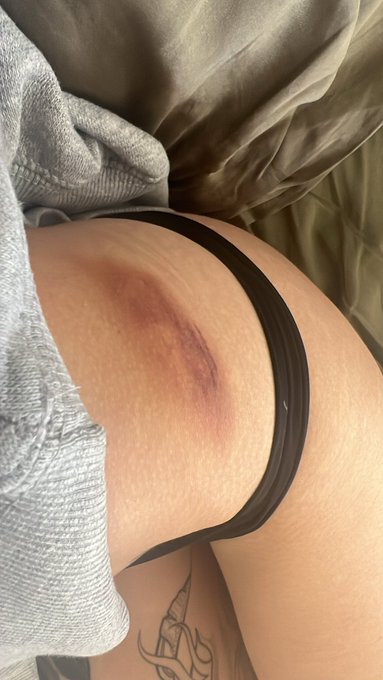 Leave it to me to go to k1 yesterday and tbone some dumbass who slammed on his breaks in the middle of