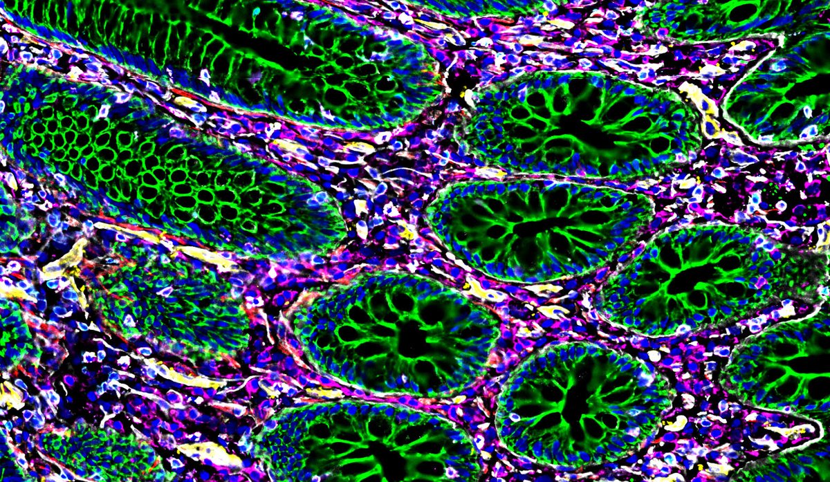 Human BioMolecular Atlas Program (HuBMAP) (@_hubmap) on Twitter photo Are you feeling offal? Then take a minute to digest the inner workings of your intestine with this CODEX image by Dr. <a href="/JohnHickey22/">John Hickey</a> from <a href="/GarryPNolan/">Garry P. Nolan</a> lab <a href="/stanford/">Stanford University</a>. We've got a gut feeling about this!
#CeliacDiseaseAwarenessDay #CeliacDisease Are you feeling offal? Then take a minute to digest the inner workings of your intestine with this CODEX image by Dr. <a href="/JohnHickey22/">John Hickey</a> from <a href="/GarryPNolan/">Garry P. Nolan</a> lab <a href="/stanford/">Stanford University</a>. We've got a gut feeling about this!
#CeliacDiseaseAwarenessDay #CeliacDisease