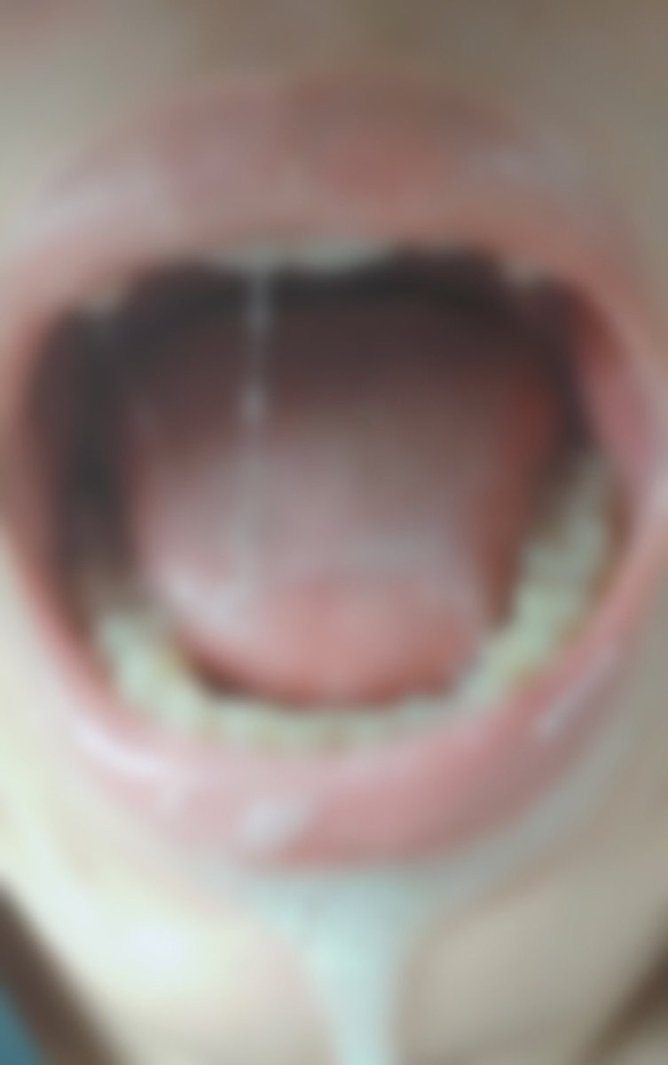 Uo5V54's tweet photo. 口内フェチの皆さんおはようございます！👅

朝一に撮影したから汚いかも！笑

唾液の糸が引いてるこの画像欲しい方はフォロー&amp;いいねとリツイートよろしくお願いします！

#唾液売ります　＃唾液販売　#唾液フェチ　#舌フェチ　#リアル調教 https://t.co/agp1toGUhJ