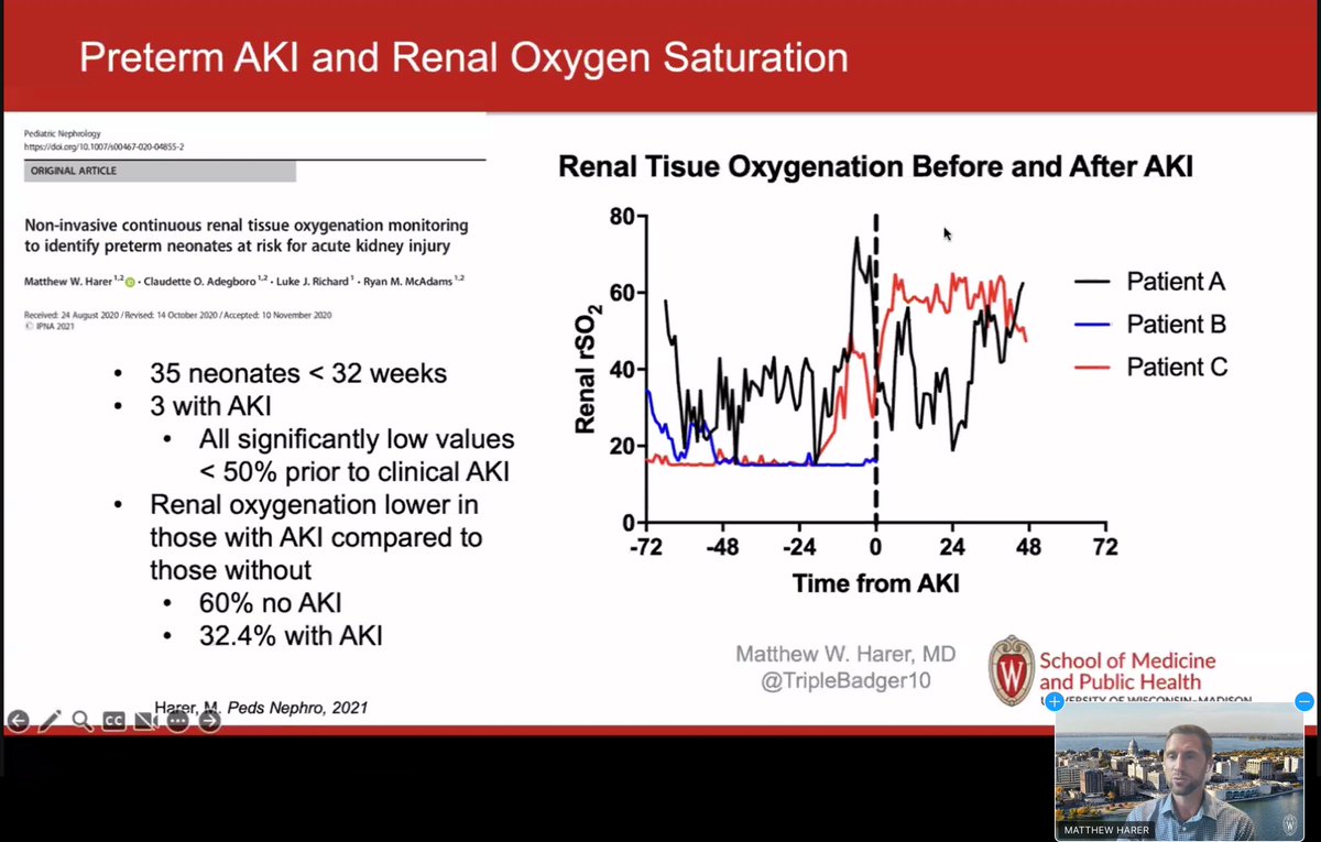 songMD's tweet photo. 2-3 x ⬆️ AKI risk in preterm infants- with higher risk at lower GA
How does NIRS help identify at risk infants?
Renal oxygenation changes precede UOP/Cr changes- ⬆️ risk with ⬆️⬆️ cumulative time <50% renal saturation
#CANcoolneo https://t.co/hy8PNQPGHa