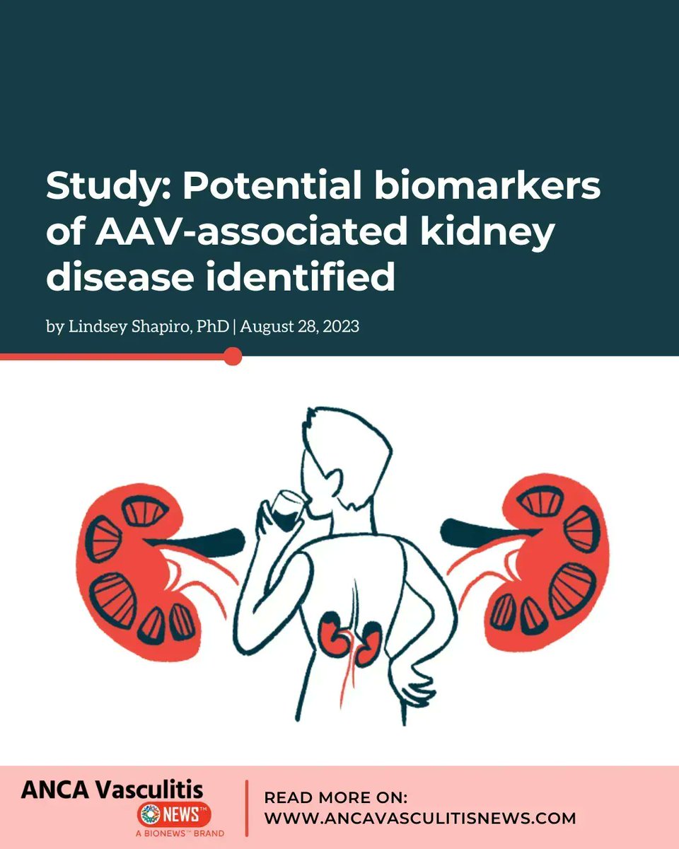 AncaVasculitis's tweet photo. Markers of microbial web formation from immune neutrophils could serve as biomarkers of ANCA-vasculitis kidney disease. 

https://t.co/MkK2dcmkXm 

#ANCAVasculitisNews #AutoimmuneHealth #InflammatoryDisorders #FightANCAVasculitis #ChronicIllness https://t.co/KFgxm0LZbF