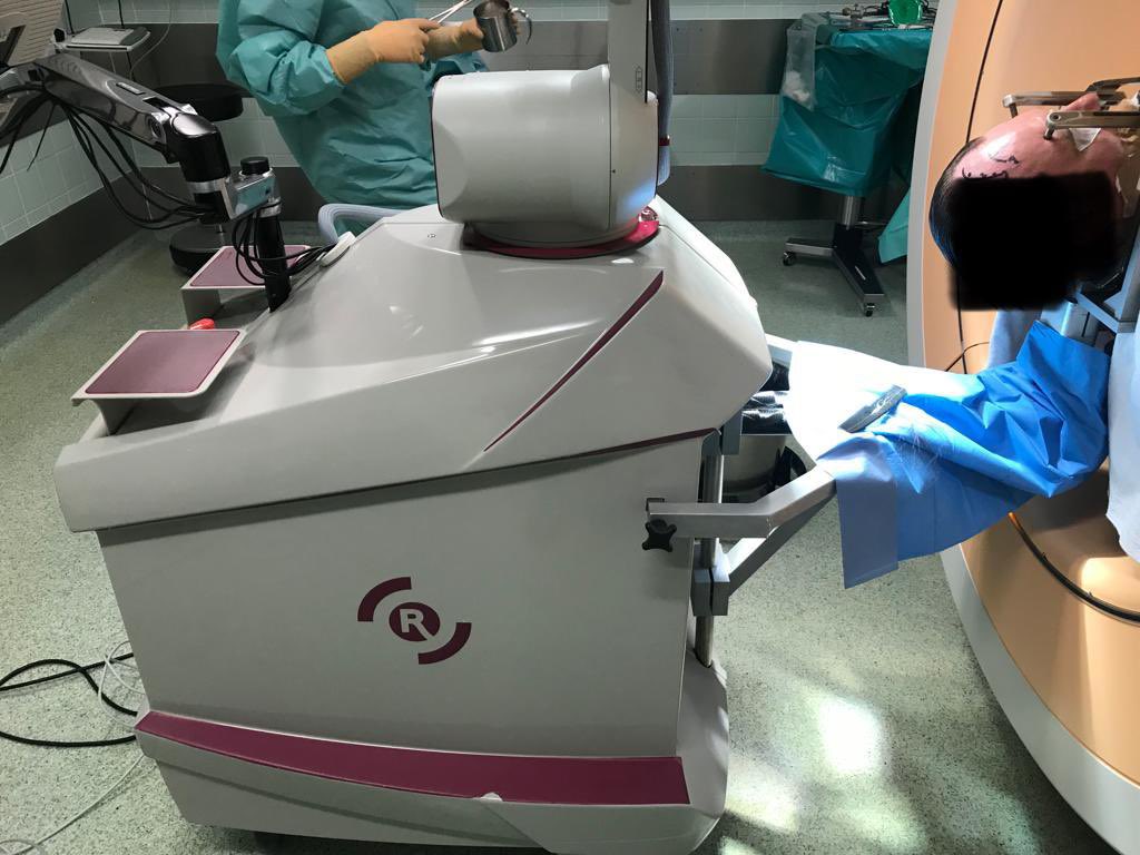 عمليات زرع محفزات الدماغ لعلاج امراض الرعاش و باركنسون بدقه عاليه بمساندة الروبوت