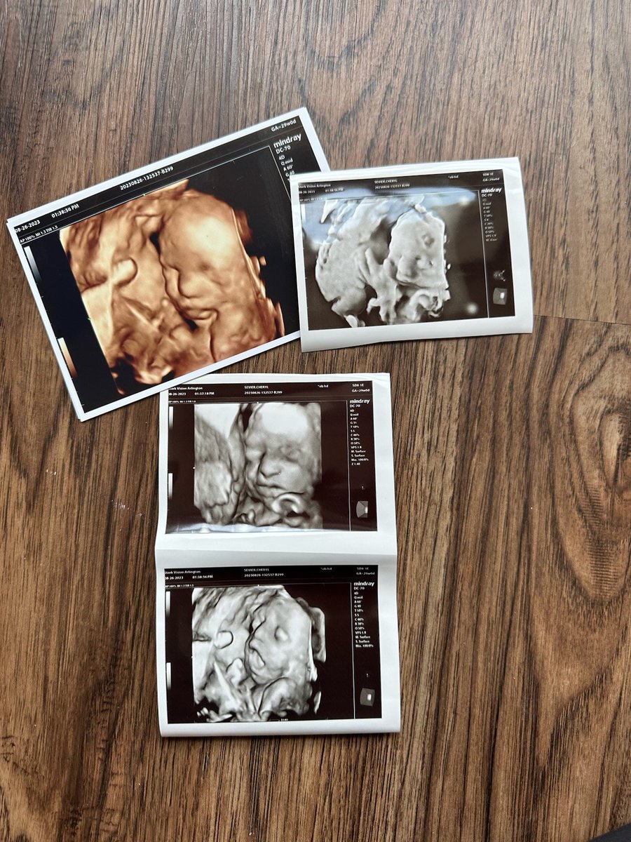 Robby Sevier tweet media