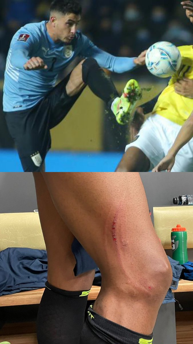 RickiVP's tweet photo. Iluso primero tapa la pelota..NO ES PENAL..
Parece que te olvidas de las veces que nos robaron a nosotros. https://t.co/R2UhCYoR88