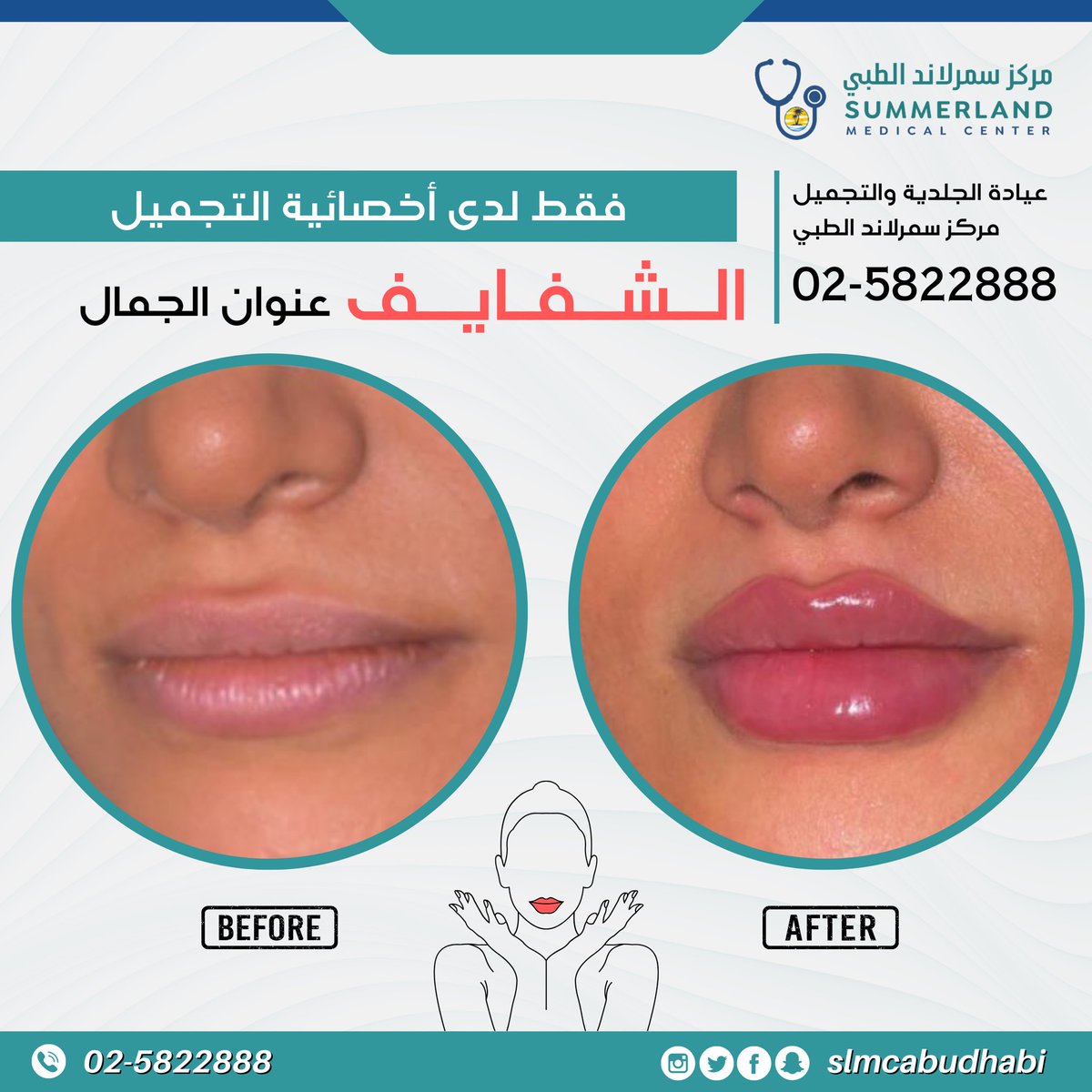 للمواعيد
الرجاء الاتصال على 025822888
اوقات العمل يوميا طوال الاسبوع من ٩ صباحا و حتى ١٠ مساء #الصحة_الوقائية #فحص_طبي #ابوظبي #عيادات #مركز_طبي #فيلر #فيلر_شفايف #فيلر_الشفايف