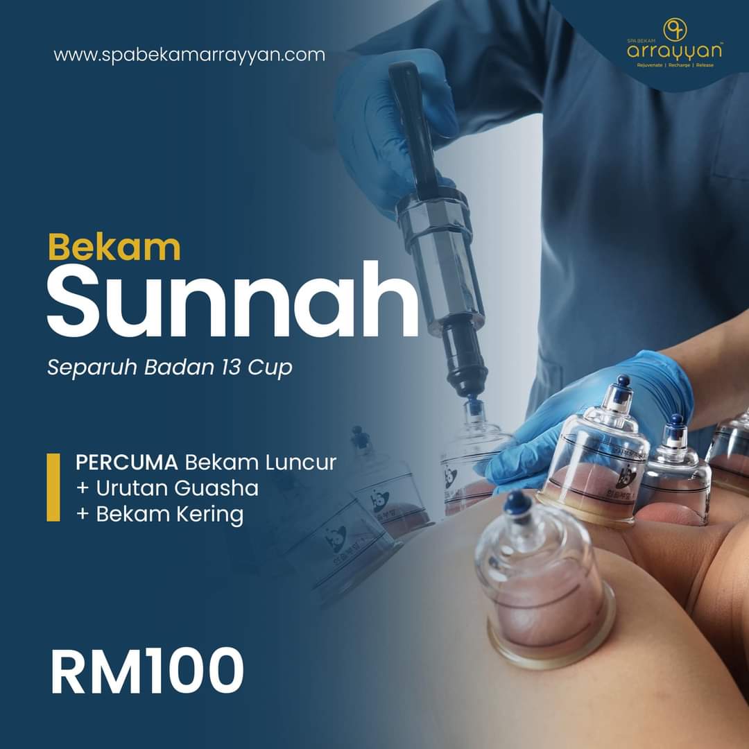 bekam_senawang's tweet image. Bekam Sunnah

#jombekam 
#spabekamarrayyan