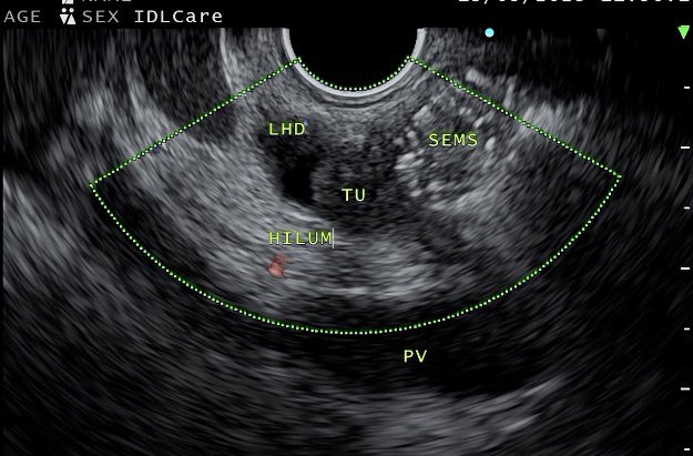 vinay dhir tweet media