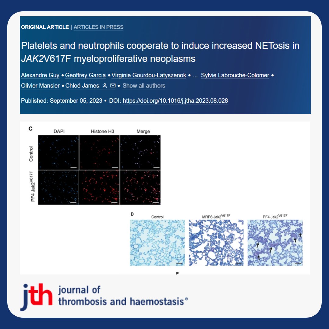 Myeloproliferative neoplasms (MPNs) 📈 proliferation myeloid progenitors in the bone marrow.

Thrombosis is main complication. 

Guy et al find that cooperation #platelets &amp; neutrophils is crucial ▶️NETosis and subsequent #thrombosis.

shorturl.at/jkpCG