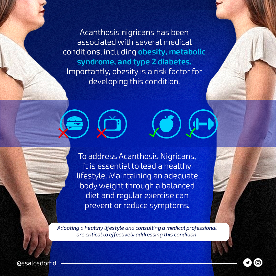 🌼 Embrace Skin Health: Understanding Acanthosis Nigricans! 🌼

Discovering Acanthosis Nigricans–ever heard of it? 🤔 This skin condition shows up as dark, thickened patches and might be a sign of underlying issues. 🚩 Let's shed light on prevention and care for glowing skin! 💆‍♀️