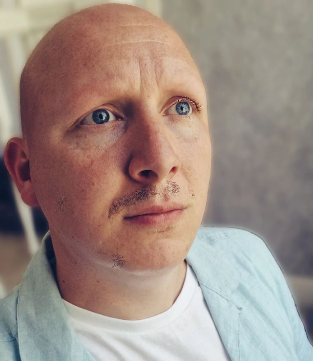 FaceEquality's tweet photo. "When I first noticed my hair falling out, I felt like I was losing a part of my identity. My confidence and self-esteem vanished. I constantly found myself battling the misconception that 'it's just hair.'"

Dean's story: https://t.co/d9haSj3BwP

#AlopeciaAwarenessMonth https://t.co/0cLFrHjZoZ