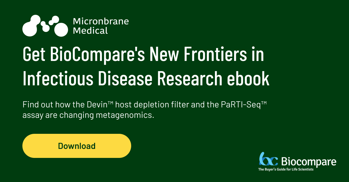 micronbrane's tweet photo. @micronbrane featured in @biocompare's New Frontiers in Infectious Disease Research eBook.

Download it here 🧬 https://t.co/ahR25XY5Wa

#Biocompare #NewFrontiers https://t.co/hiifsiHmdA