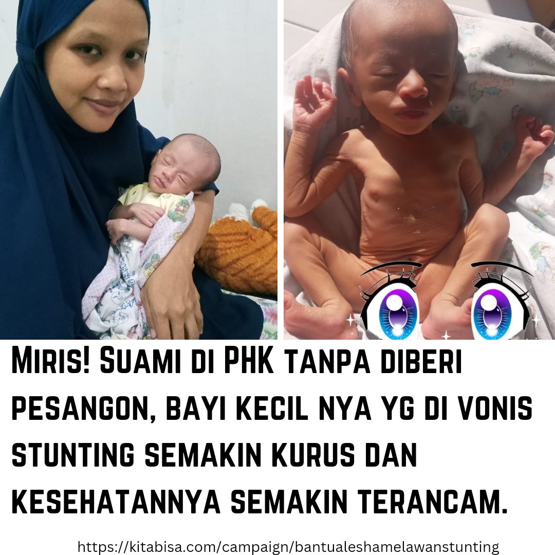cutepooodle's tweet photo. TWITTER DO YOUR MAGIC!!
BANTU LIKE & RT.

Perkenalkan bayi malang ini bernama Alesha assyfa fahtarani, usianya saat ini 6 minggu dengan kondisi kekurangan gizi. Awal lahir, semua tampak baik2 saja, kondisi berat badan nya normal. Namun, setelah 7 hari, kondisi fisiknya berubah menjadi kurus bahkan saat ini semakin memprihatinkan.

Ayahhya di PHK seminggu sebelum Alesha lahir, dan sekarang bekerja serabutan dengan penghasilan yg tidak menentu. Semua barang sudah terjual demi menyambung hidup. Setiap rezeki yg di dapat, Ayahnya sisihkan untuk bisa membawa anak nya berobat.
Dengan berbekal uang seadanya, orangtua Alesha hanya mampu membawanya ke bidan, disana bidan berkata bahwa Alesha mengalami stunting dan harus kontrol ke DSA. Namun karena keterbatasan ekonomi, sampai saat ini Alesha blm bisa di bawa ke DSA, bahkah untuk memenuhi kebutuhan gizinya saja orangtua sudah tidak mampu. Saat ini Alesha sangat membutuhkan bantuan susu bernutrisi tinggi, serta perlengkapan bayi lainnya.

Ayo teman-teman dermawan bantu penuhi kebutuhan gizi Alesha, dengan berdonasi melalui https://t.co/zG5fPvDJNN