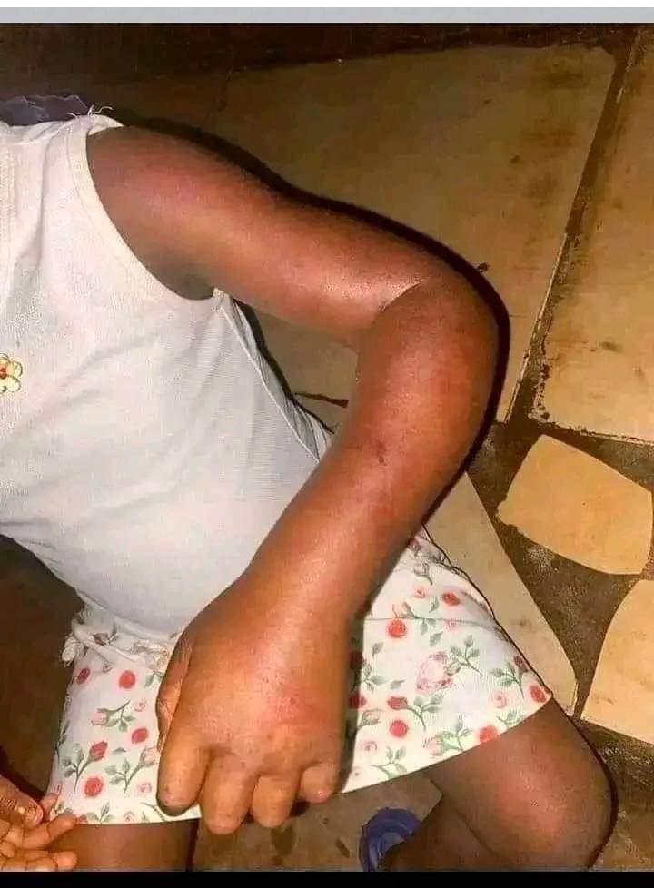 mubaiwa_anna's tweet photo. Mapurisa eZimbangagwa mari iya yamaida kupa anoku udzai kuna Promise Mkwananzi chipayi vanhu vatsvage step Mother varikunzi vakarova baby uyu..
#STOPABUSINGCHILDREN https://t.co/MynLMFlEvy
