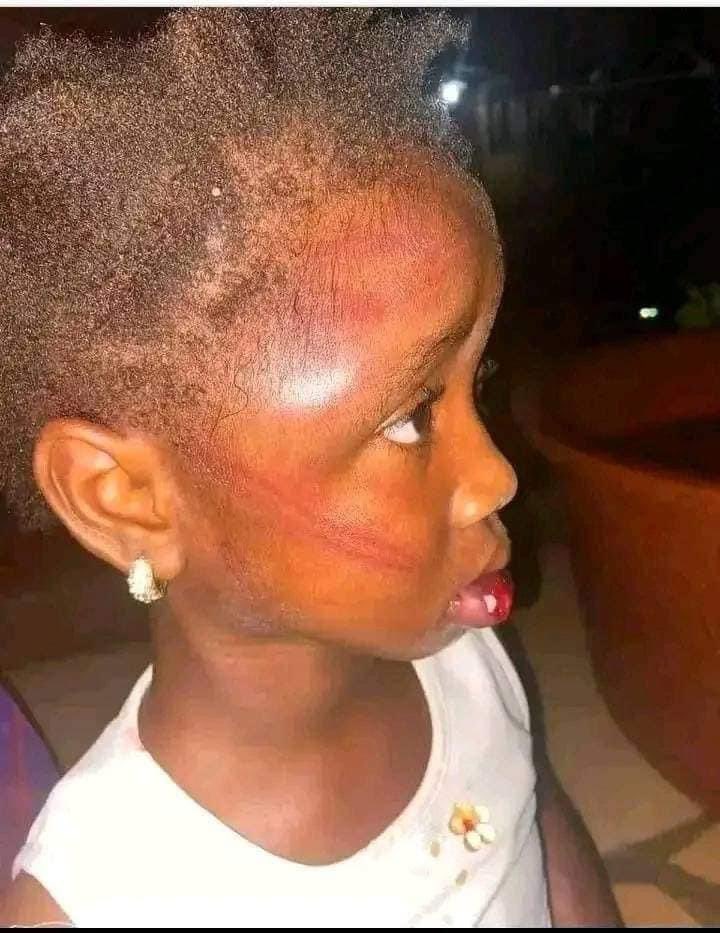 mubaiwa_anna's tweet photo. Mapurisa eZimbangagwa mari iya yamaida kupa anoku udzai kuna Promise Mkwananzi chipayi vanhu vatsvage step Mother varikunzi vakarova baby uyu..
#STOPABUSINGCHILDREN https://t.co/MynLMFlEvy