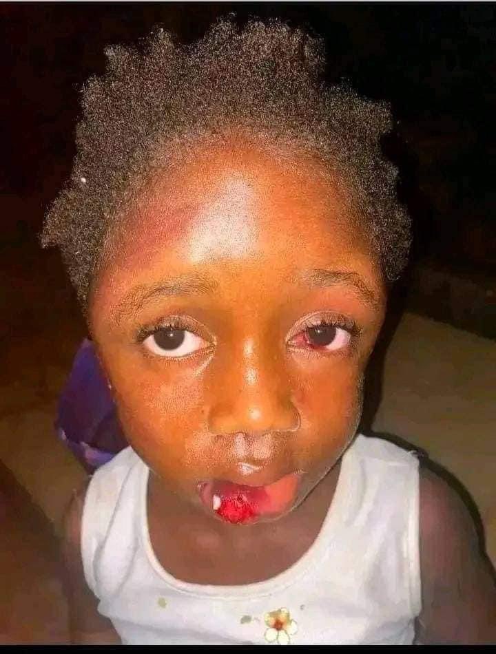 mubaiwa_anna's tweet photo. Mapurisa eZimbangagwa mari iya yamaida kupa anoku udzai kuna Promise Mkwananzi chipayi vanhu vatsvage step Mother varikunzi vakarova baby uyu..
#STOPABUSINGCHILDREN https://t.co/MynLMFlEvy