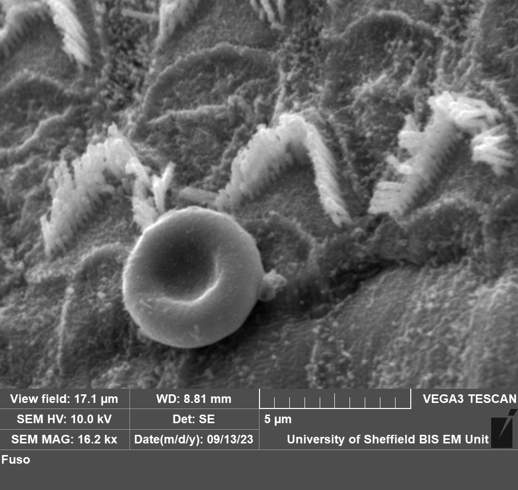 I was taking some images on the scanning electron microscope this morning and found this gem - The red blood cell gives a nice perspective of just how tiny stereocilia are! For reference, the magnification of this image of outer hair cell stereocilia is 16,200x