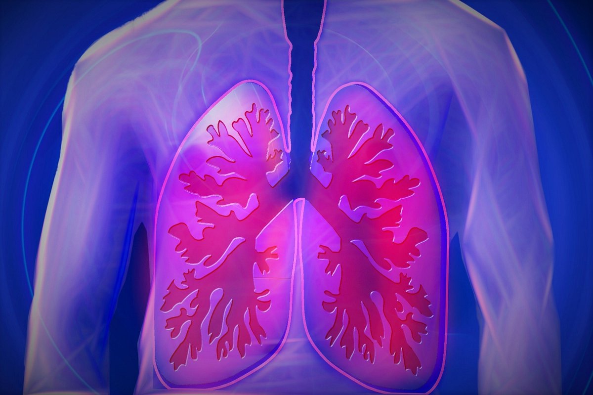 ReNeural's tweet photo. Patient-derived #stemcells shown to be effective in treating symptoms of #COPD. #Lung stem cells repaired damage, allowing participants in a phase I #clinicaltrials to breathe easier and resume more normal activities.
#COPDAwareness #COPDResearch
https://t.co/A7TCg8fKRR https://t.co/bKf3wfhGWf