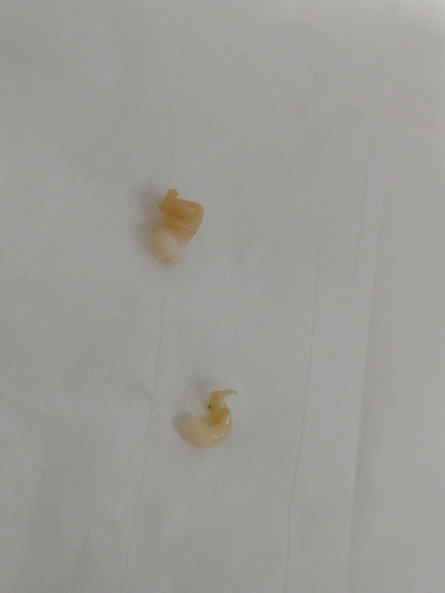 nikukiuupuni's tweet photo. レオパの様子がおかしかったんです。
タマタマがすこし大きいような気がして
他の子と触ってみて確かめるとかたい。。

総排泄腔めくってまさぐってみたら
ビンゴ、こんなに大きなプラグありました。
痛かったねぇ…。

ふつうタマタマは柔らかいので触っておかしかったら調べてみる価値ありですね…。 https://t.co/vcbmVU0Ora