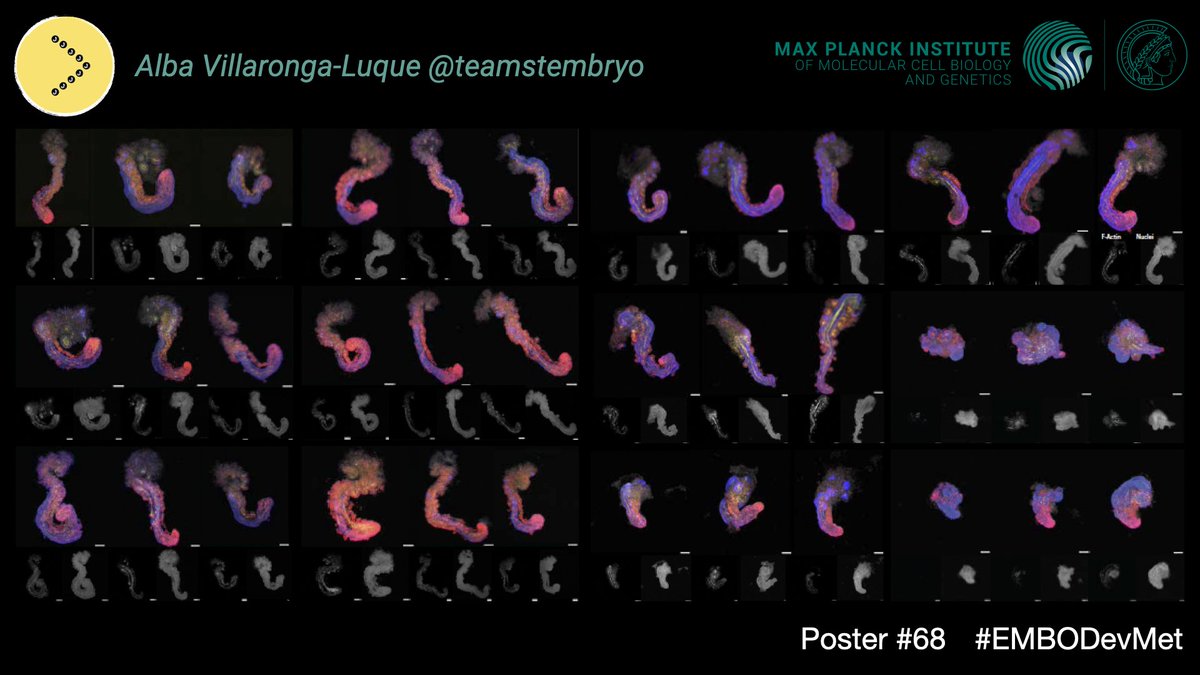 jesse veenvliet @jesseveenvliet.bsky.social (@jvveenvliet) on Twitter photo Are you at #EMBODevMet? Then check out poster #68 by <a href="/VillarongaAlba/">Alba Villaronga</a> <a href="/teamstembryo/">teamstembryo</a> <a href="/imprs_mpicbg/">IMPRS-CellDevoSys</a> about the link between divergent metabolic activity, differentiation outcome and morphological variation in #stembryos (co-lead by <a href="/RyanSavill4/">Ryan Savill</a>). Are you at #EMBODevMet? Then check out poster #68 by <a href="/VillarongaAlba/">Alba Villaronga</a> <a href="/teamstembryo/">teamstembryo</a> <a href="/imprs_mpicbg/">IMPRS-CellDevoSys</a> about the link between divergent metabolic activity, differentiation outcome and morphological variation in #stembryos (co-lead by <a href="/RyanSavill4/">Ryan Savill</a>).