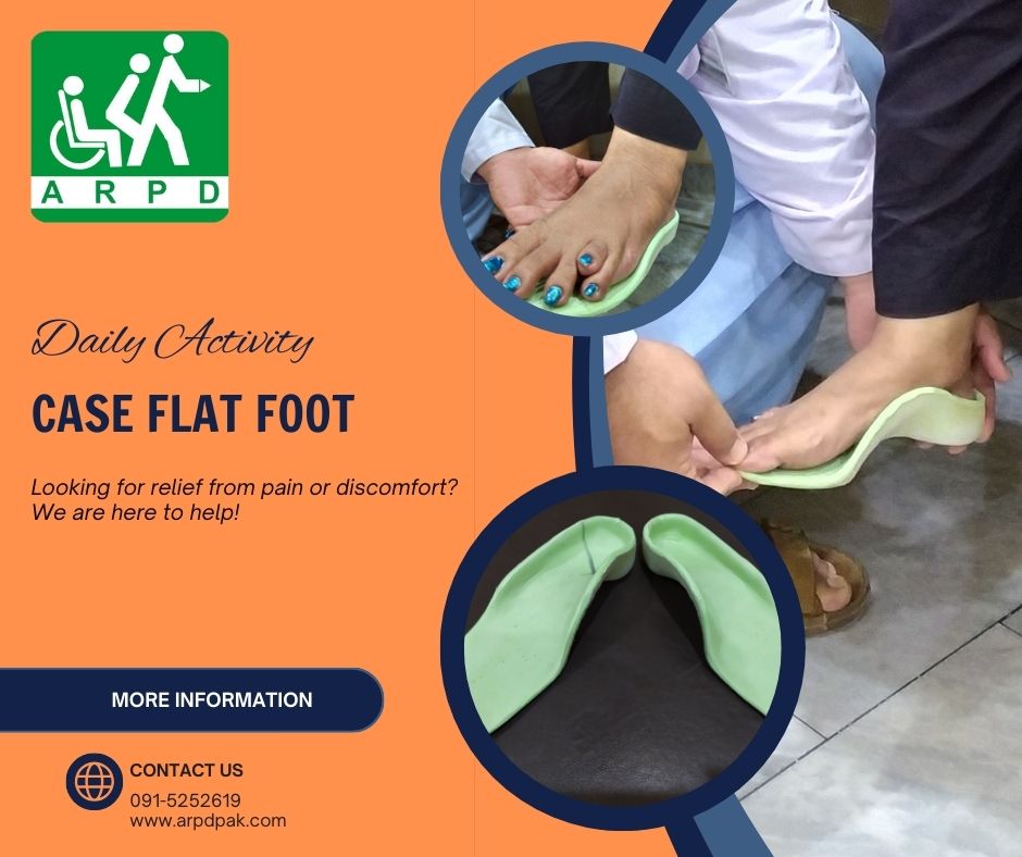 HHCSARPD's tweet photo. Case flat foot
Appliance Bilateral Medial Arch support.
Association for the Rehabilitation of the Physically Disabled
#arpd #physioterapy #peshawar #rcpd #helpingothers #helpinghearts #rehabilitation #skillsdevelopment #SkillsForLife #skills https://t.co/0RW1YCIjGa