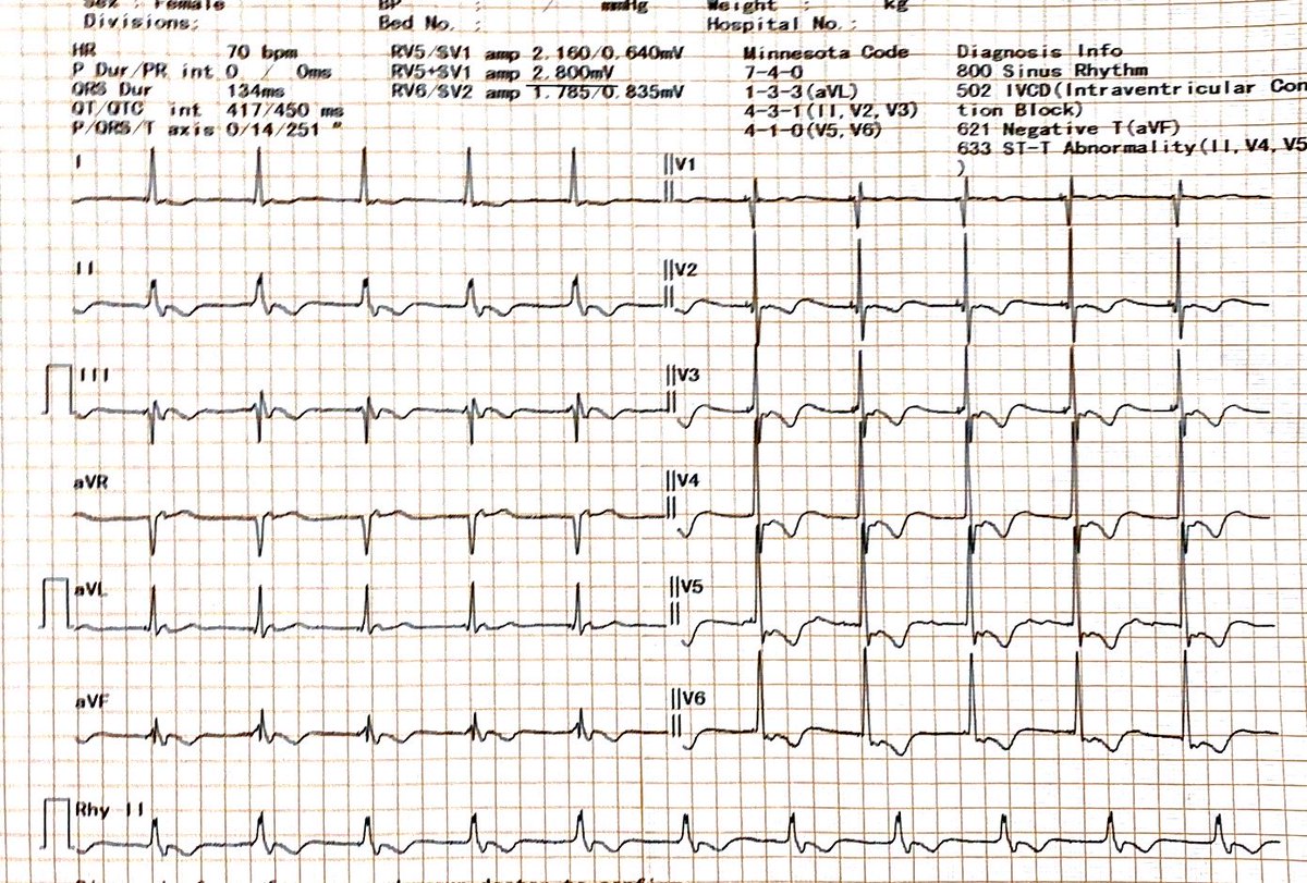 ECG for residents/Fellows.