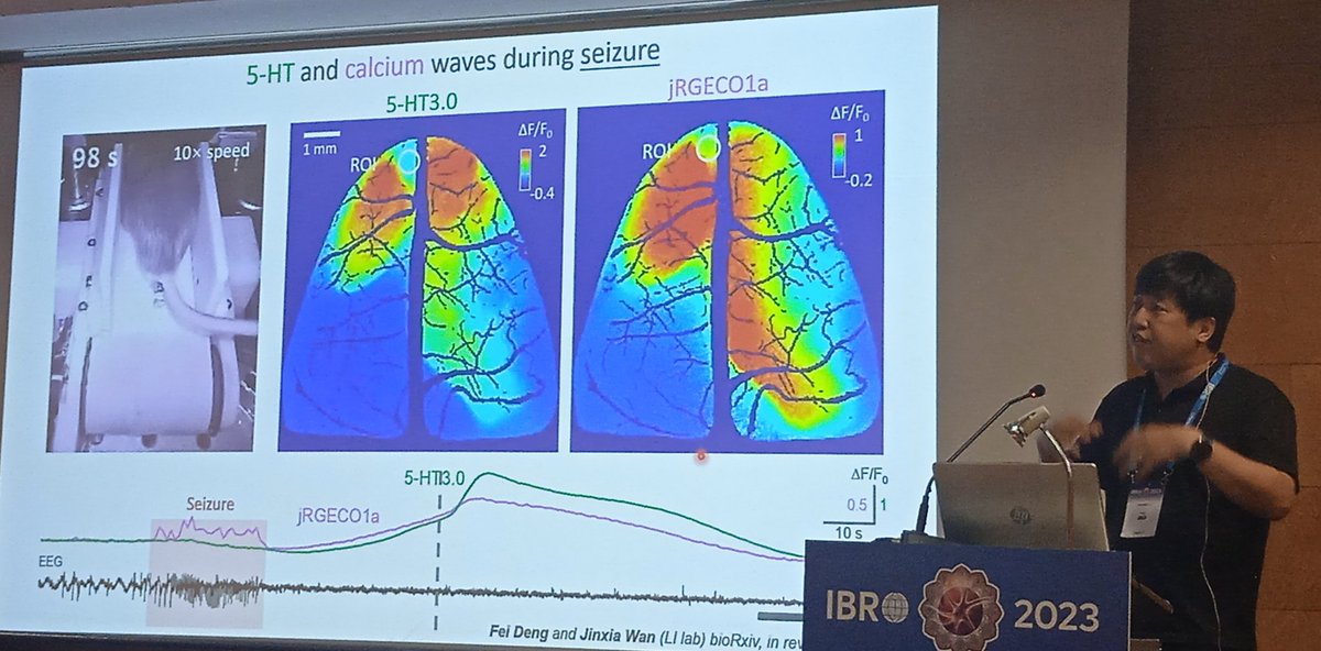 The best moment #IBRO23 thanks to Yulong Li for the amazing and inspiring talk and @BGarcialab to support my presence in @IBROorg. Intense days of sharing knowlegment. Take home message:'Can we do better?' - Yulong Li. We can always do better if you did not give up!