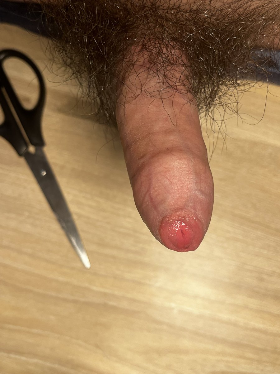 meverybb's tweet photo. dangerous #包茎 #phimosis https://t.co/aCNNBNuVRq