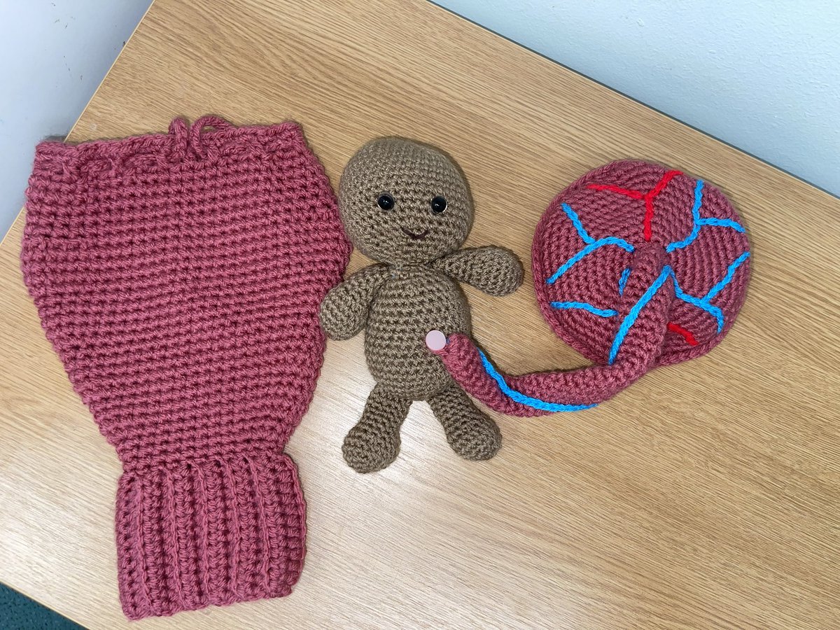 I absolutely love this present from one of the @CAV_ECOD team! A knitted uterus baby and placenta! I shall bring it with me for #adultlearnersweek next week! @CV_UHB @andrew_ecod_cav @asilLF