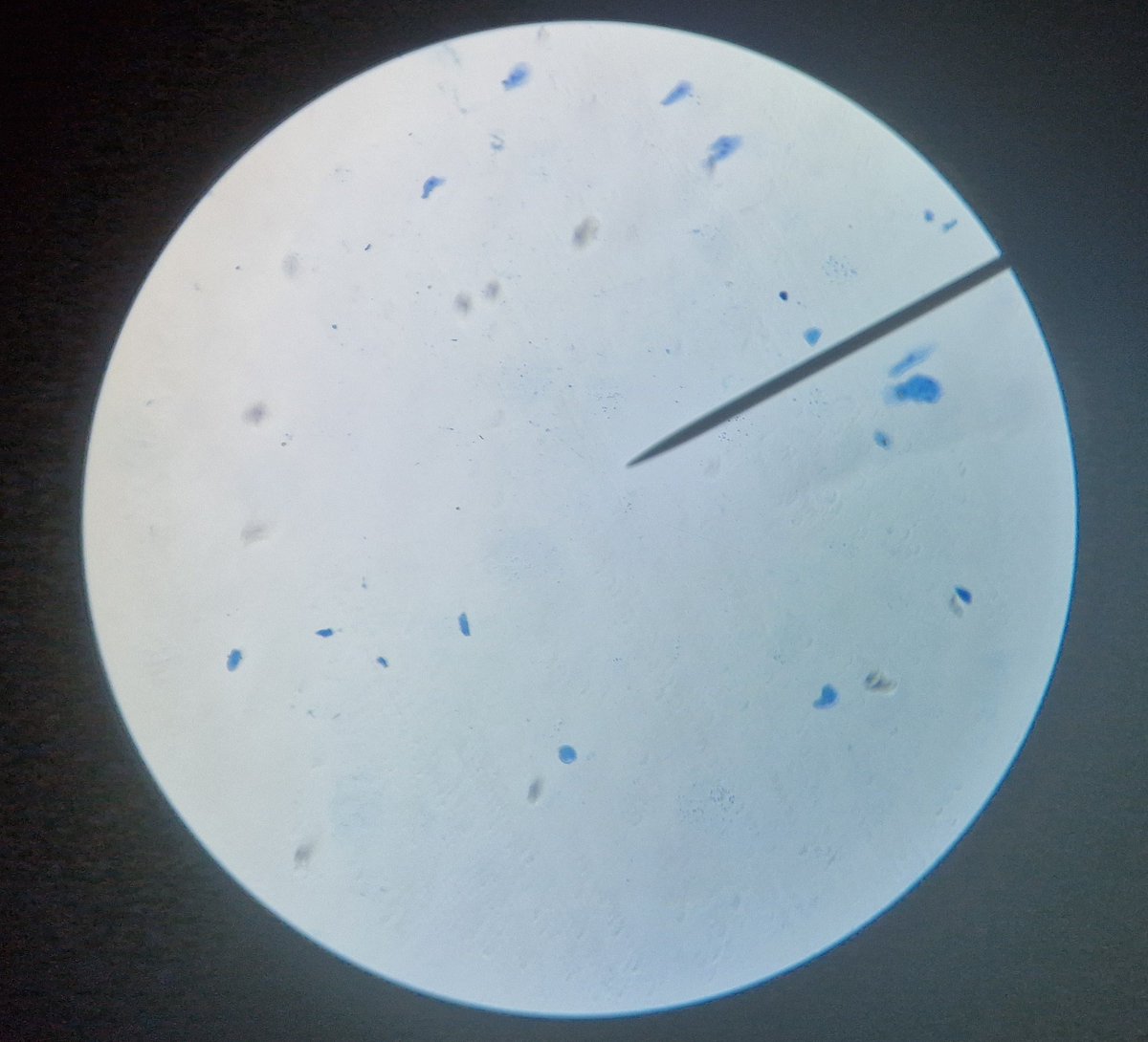 SmithycroftPhys's tweet photo. It was 1Bs turn this week to look at their own cheek cells under the microscope! π¬
They did a brilliant job following instructions and helping each other, and they all got amazing results! Well done π
#ScienceIsFun #ScienceIsNurturing #EverydayScience https://t.co/le2oy4S0F6