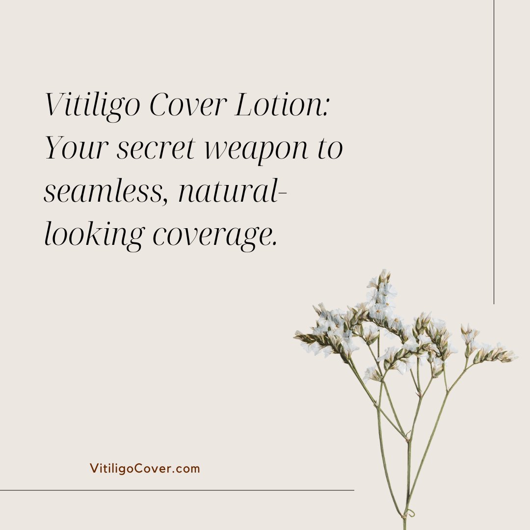 VitiligoVoices's tweet photo. https://t.co/avMDUtqlQ1