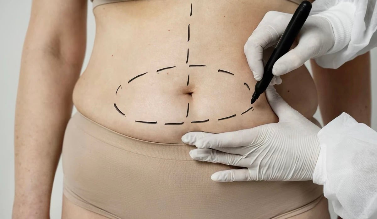 AmatoClinic's tweet photo. Descubra mais sobre VASER e Lipoaspiração ultrassônica! Uma tecnologia que melhora os resultados da lipoaspiração. Menos dor, inchaço e tempo de recuperação? Saiba como é possível em nosso novo artigo. 💪👩‍⚕️🔬 https://t.co/383LyYTkdL #AmatoClinic #saúde #bemestar https://t.co/bNhndHxS9i