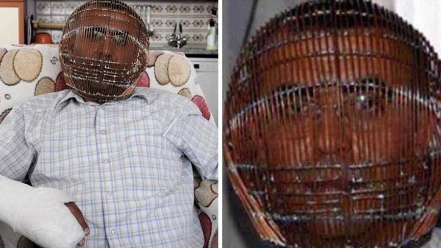 In 2013, a man locked his head in a cage to try quit smoking. Ibrahim Yücel from Turkey took the drastic measure to quit after other methods failed. A life long smoker Ibrahim was terrified the cigarettes were going to prematurely end his life after his father, also a life long…