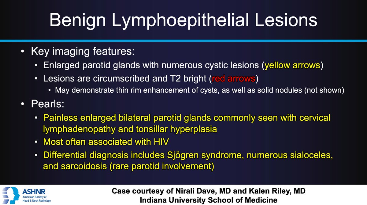 #ASHNRCOTW #227 ANSWER: Benign lymphoepithelial lesions! Thx Drs. <a href="/ndave08/">Nirali Dave</a> &amp; <a href="/KRileyMD/">Kalen Riley</a> <a href="/IURadiology/">IU Radiology and Imaging Sciences</a> 4 case! #ASHNR23

<a href="/AshokSrini15/">Ashok Srinivasan</a> <a href="/callyrobs/">Caroline Robson, MBChB</a> <a href="/DShatzkes/">Deborah Shatzkes</a> <a href="/CDP_Rad/">C Douglas Phillips 🇺🇸</a> <a href="/rhwiggins/">Richard Wiggins</a> <a href="/nakoontz/">Nicholas Koontz</a> <a href="/cmtomblinson/">Courtney Tomblinson, MD</a> <a href="/WmOBrienDO/">William T. O'Brien, DO 🧠🩻</a> <a href="/ESHNRSociety/">ESHNR</a> <a href="/TheASNR/">The American Society of Neuroradiology</a> <a href="/tabby_kennedy/">Tabby A. Kennedy, MD</a> <a href="/CMGlastonbury/">Christine M Glastonbury, MD</a> <a href="/PhilipRChapman1/">Philip R. Chapman, MD</a>