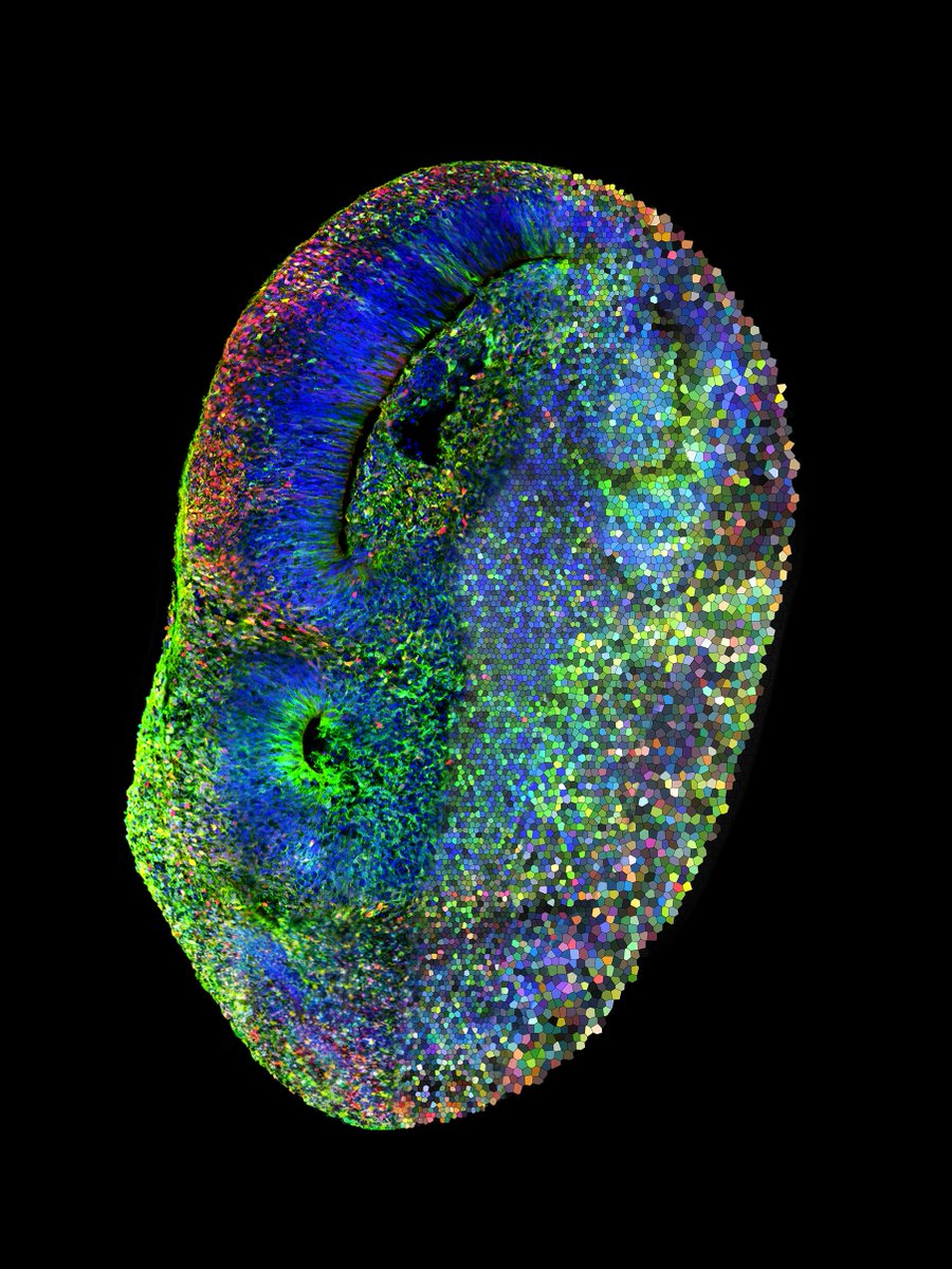 IMBA imbavienna.bsky.social (@imba_vienna) on Twitter photo Does the human brain have an Achilles heel that ultimately leads to #Autism? With <a href="/TreutleinLab/">Treutlein lab</a> (<a href="/ETH_en/">ETH Zurich</a>) & <a href="/MedUni_Wien/">MedUni Wien</a>, <a href="/Knoblich_lab/">The Knoblich Lab</a> researchers led by <a href="/ChongLi_cl/">Chong Li</a> develop CHOOSE, a revolutionizing system to test multiple disease-related mutations in a single #brain #organoid. Does the human brain have an Achilles heel that ultimately leads to #Autism? With <a href="/TreutleinLab/">Treutlein lab</a> (<a href="/ETH_en/">ETH Zurich</a>) & <a href="/MedUni_Wien/">MedUni Wien</a>, <a href="/Knoblich_lab/">The Knoblich Lab</a> researchers led by <a href="/ChongLi_cl/">Chong Li</a> develop CHOOSE, a revolutionizing system to test multiple disease-related mutations in a single #brain #organoid.