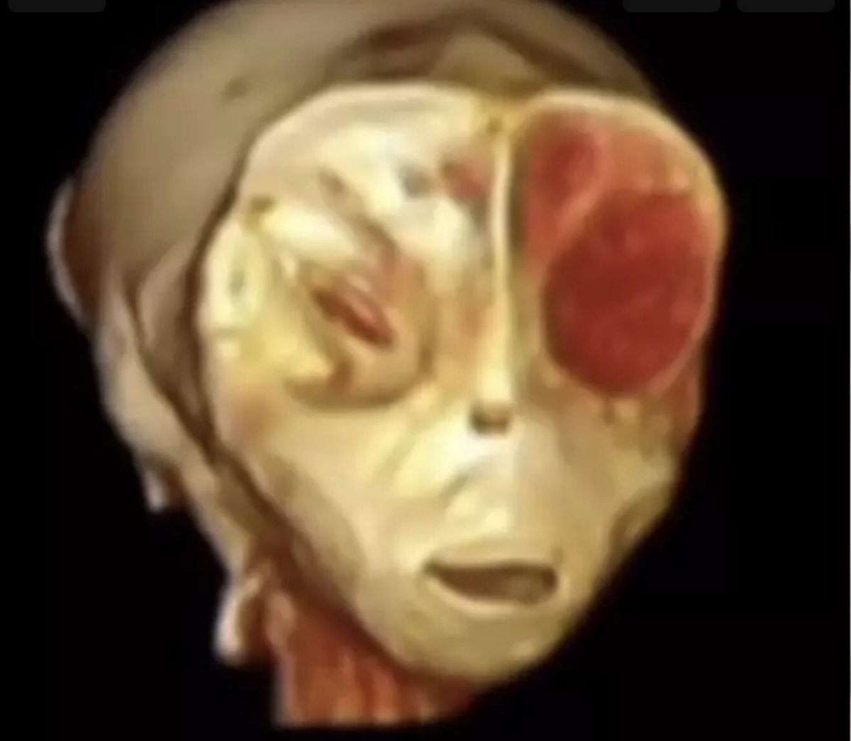 Brian Roemmele tweet media