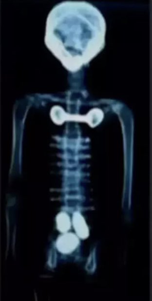 Brian Roemmele tweet media