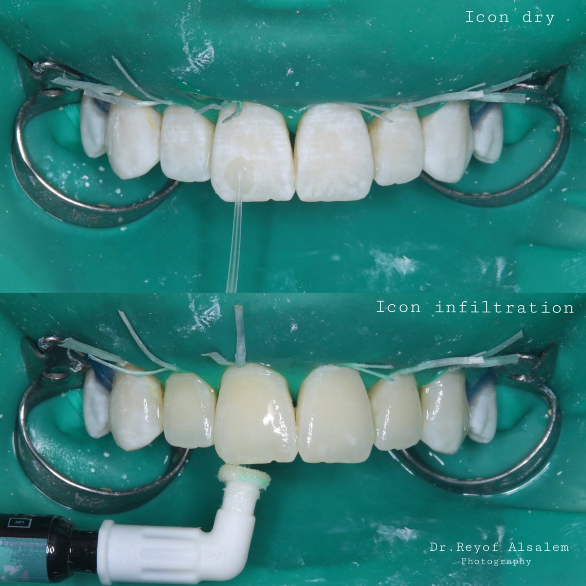 Reyof Alsalem🦷 tweet media