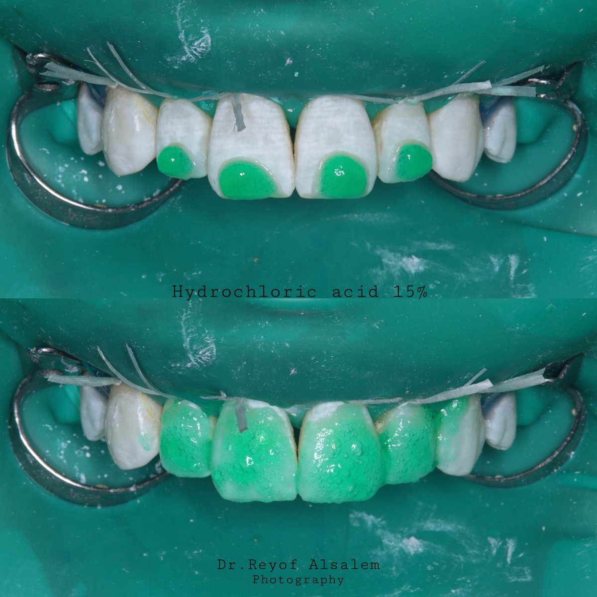 Reyof Alsalem🦷 tweet media