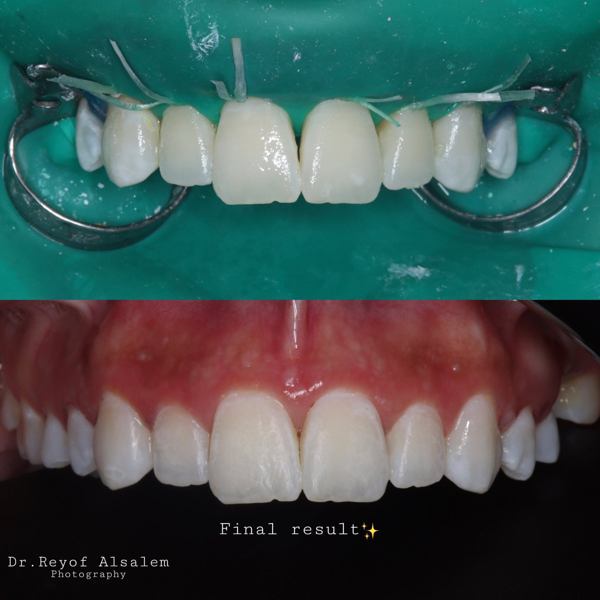 Reyof Alsalem🦷 tweet media