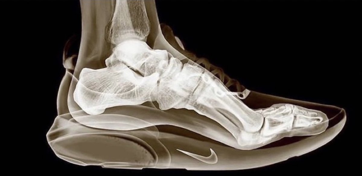 I guarantee the shoes you’re wearing are damaging your health Modern ...