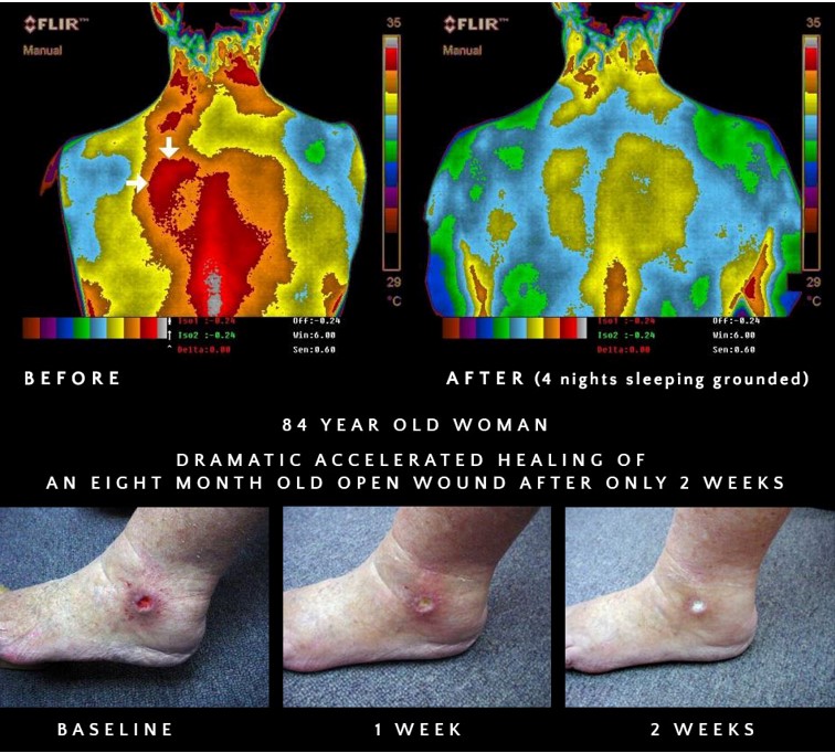 One of the most underrated habits I do for my body and brain is grounding.

Grounding is a form of therapy that involves doing activities that reconnect us with the Earth.

You can do this by touching your feet to grass, swimming in the ocean, or using a grounding mat.
Research