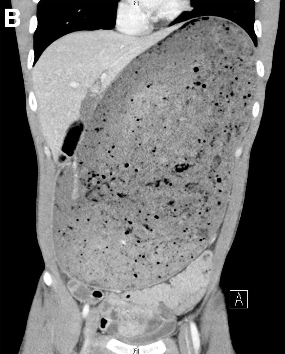 Keith Siau tweet media