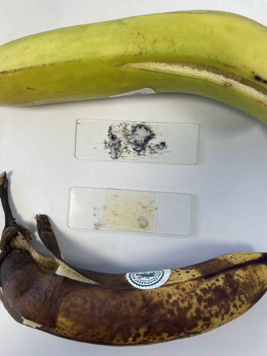 ScienceAtTowers's tweet photo. Our GCSE Biologists used iodine solution to compare the starch content in ripe and unripe bananas today 🍌🔬

The blue/black colour on the unripe banana slide indicates the presence of starch. As bananas ripen, enzymes break the starch down into sugars. https://t.co/7YFCRuhlvl