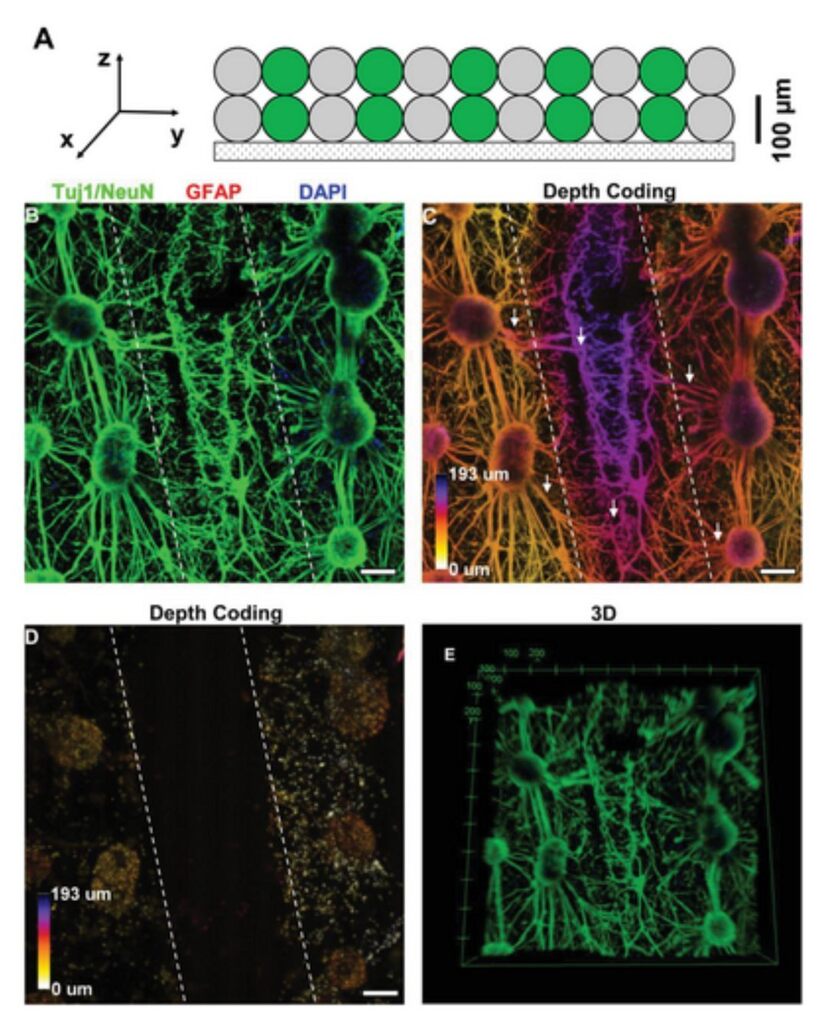 3dheals's tweet photo. New publication: 3D Functional #Neuronal #Networks in Free-Standing #Bioprinted #Hydrogel Constructshttps://bit.ly/3PfN4EX
#bioprinting #bioprinter #tissueengineering #regenerativemedicine #nanotechnology #bioimpression #medical3dprinting #biomedical #me… https://t.co/lSYMtQJ5uv https://t.co/721r7U4yMe