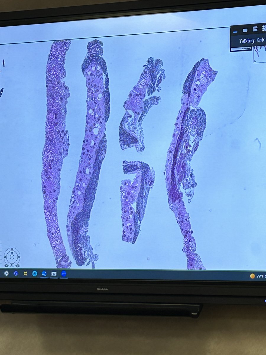 UNMC Kidney tweet media