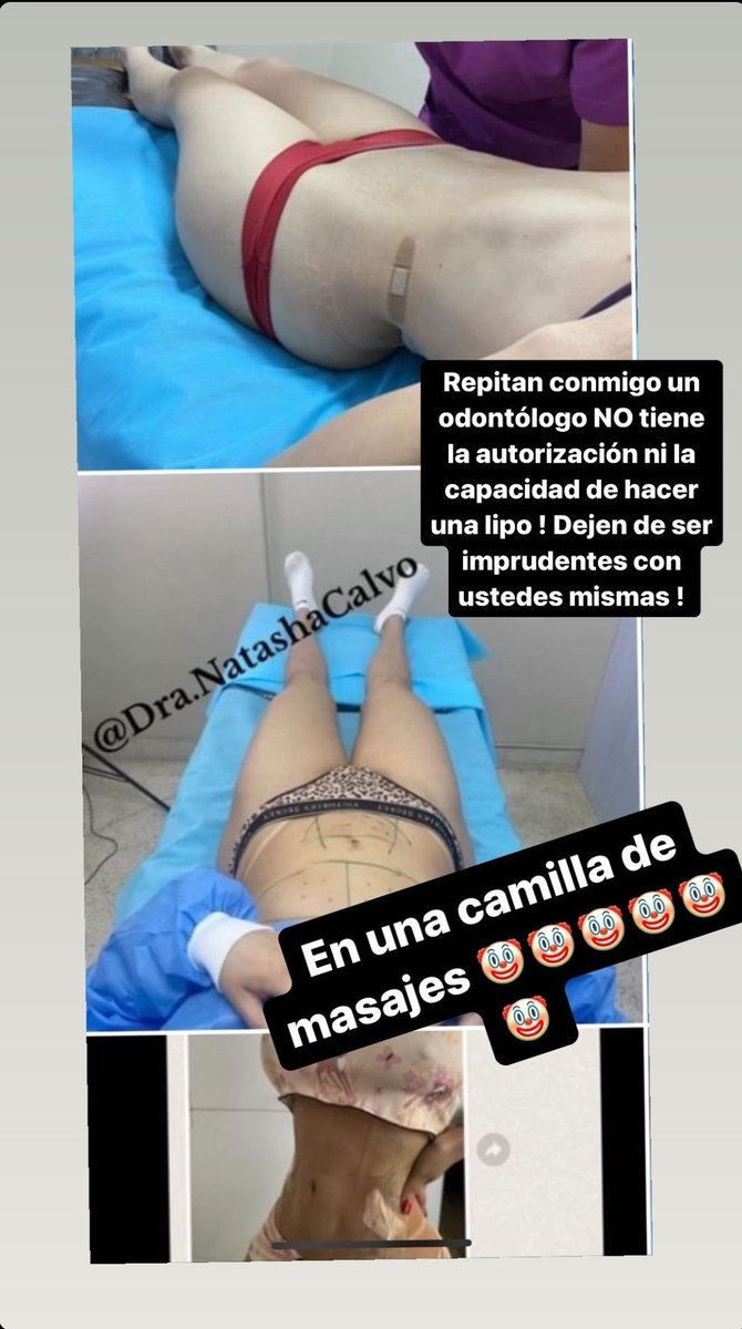 Sin palabras