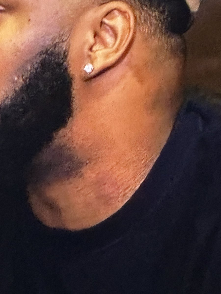 reallyleaah's tweet photo. Maybe it’s me, but the last episode @chefdeemonsterr is this a hickey boo lol https://t.co/O8nqb9QPQa