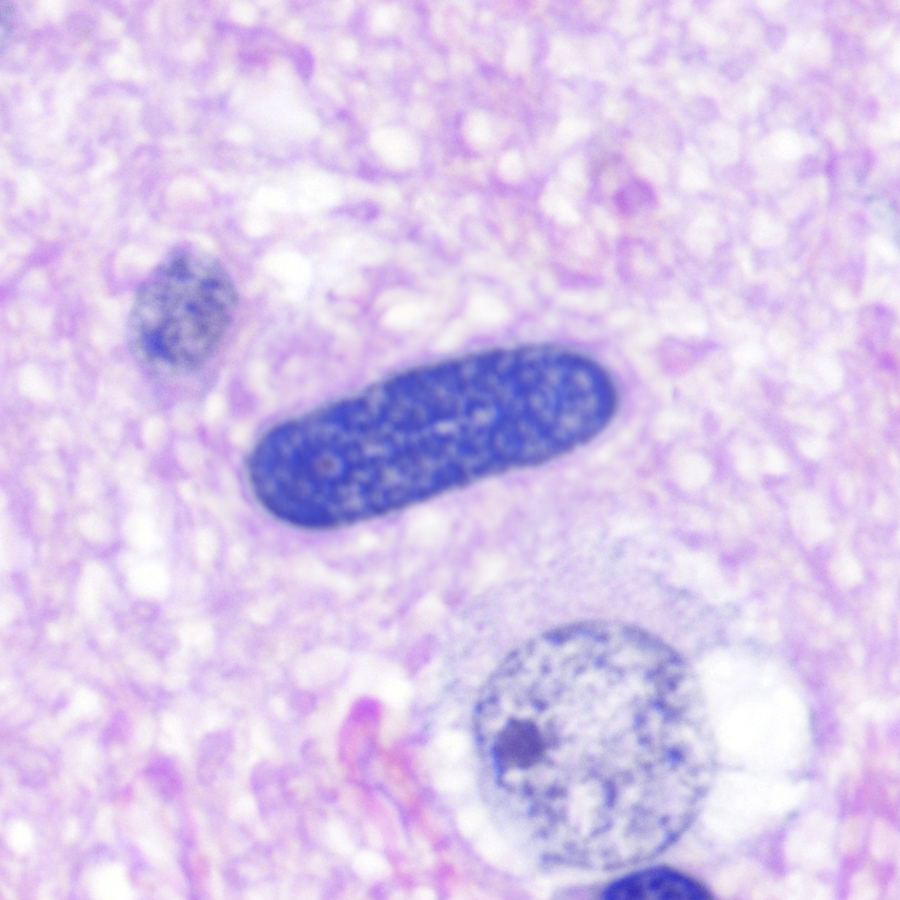 Photoshop's new AI-driven image manipulation system is unnerving. Compare the original image I took on the left with the altered one on the right.
How can we trust photomicrographs in scientific papers anymore? Is there a way for journals to figure out what's real vs. altered?