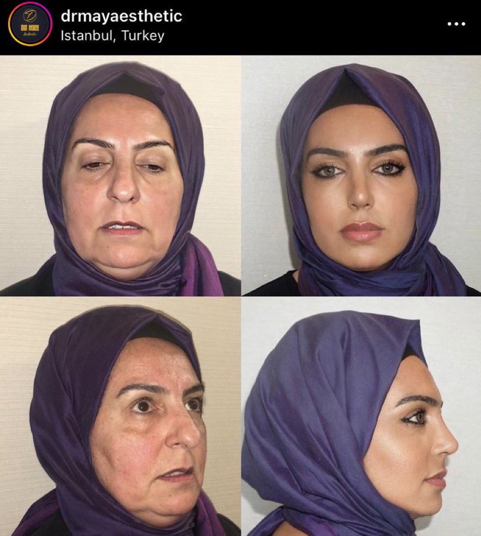 Turkish surgeons doing black magic.