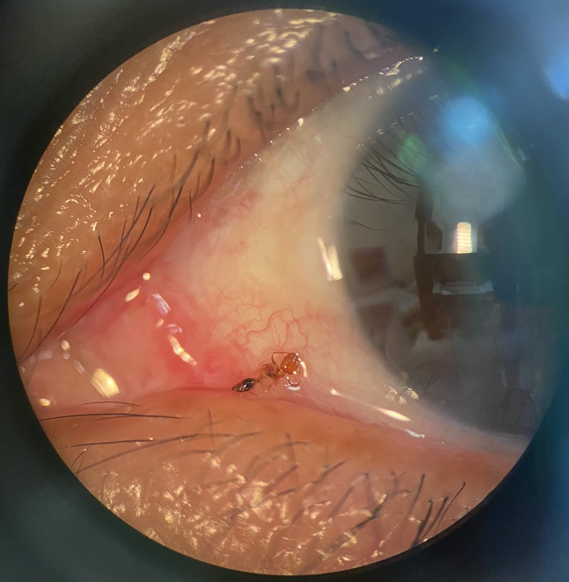 El Sol de Oftalmo tweet media